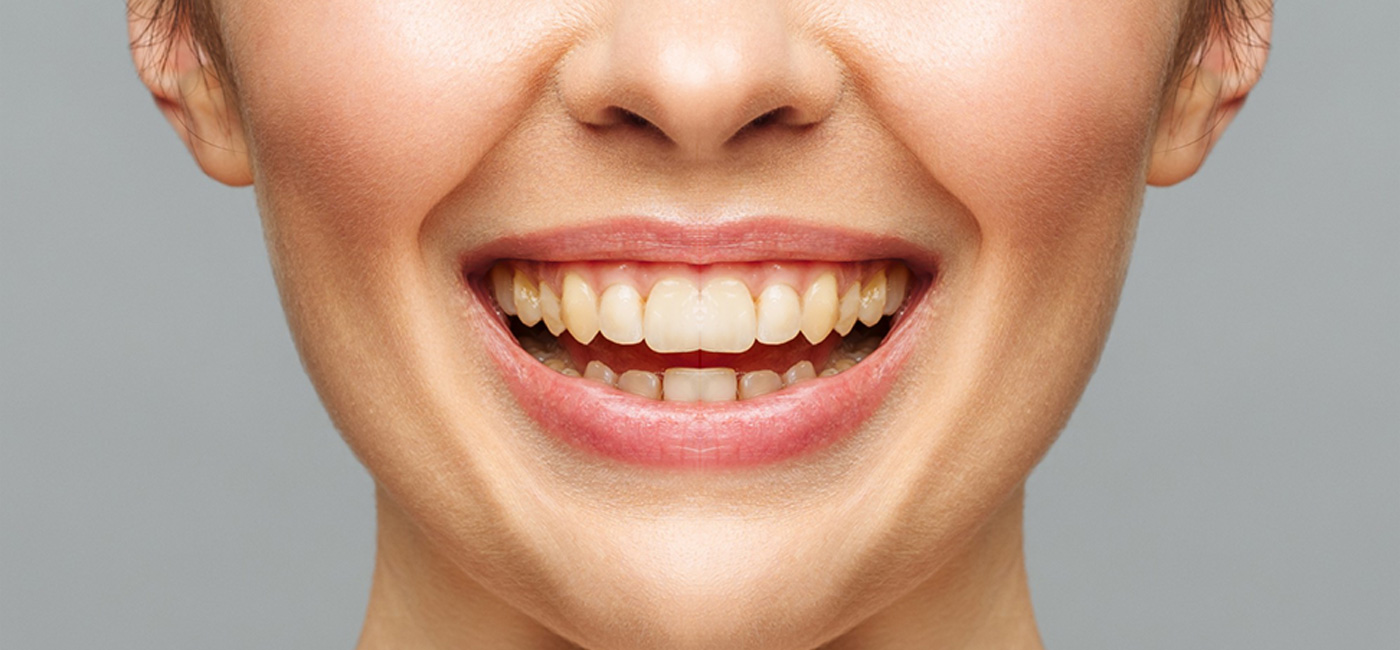 Best Dental Clinic in Navi Peth, Pune | Qualicare Polyclinic