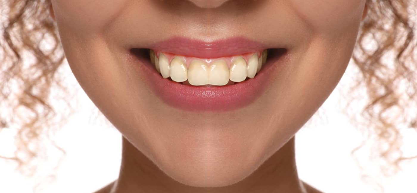 Best Dental Clinic in Navi Peth, Pune | Qualicare Polyclinic