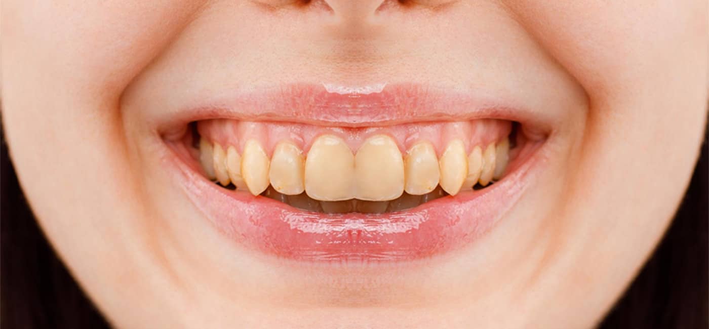 Best Dental Clinic in Navi Peth, Pune | Qualicare Polyclinic