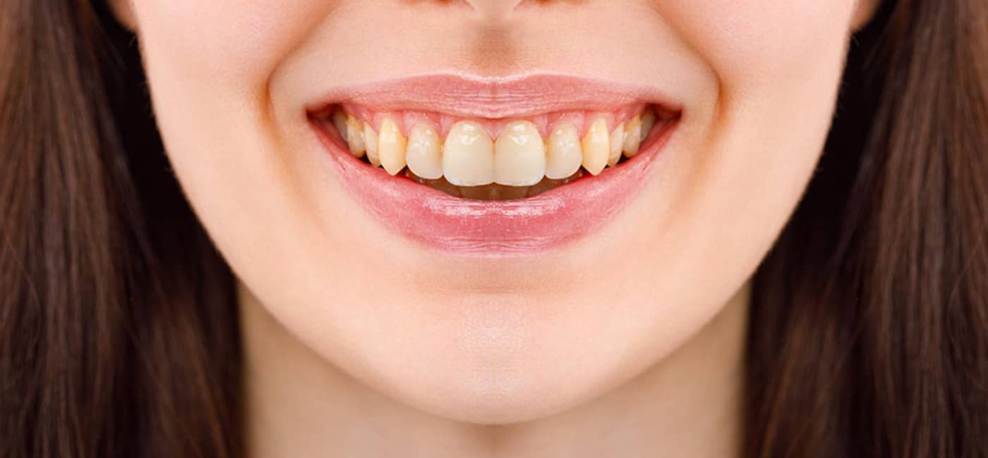 Best Dental Clinic in Navi Peth, Pune | Qualicare Polyclinic