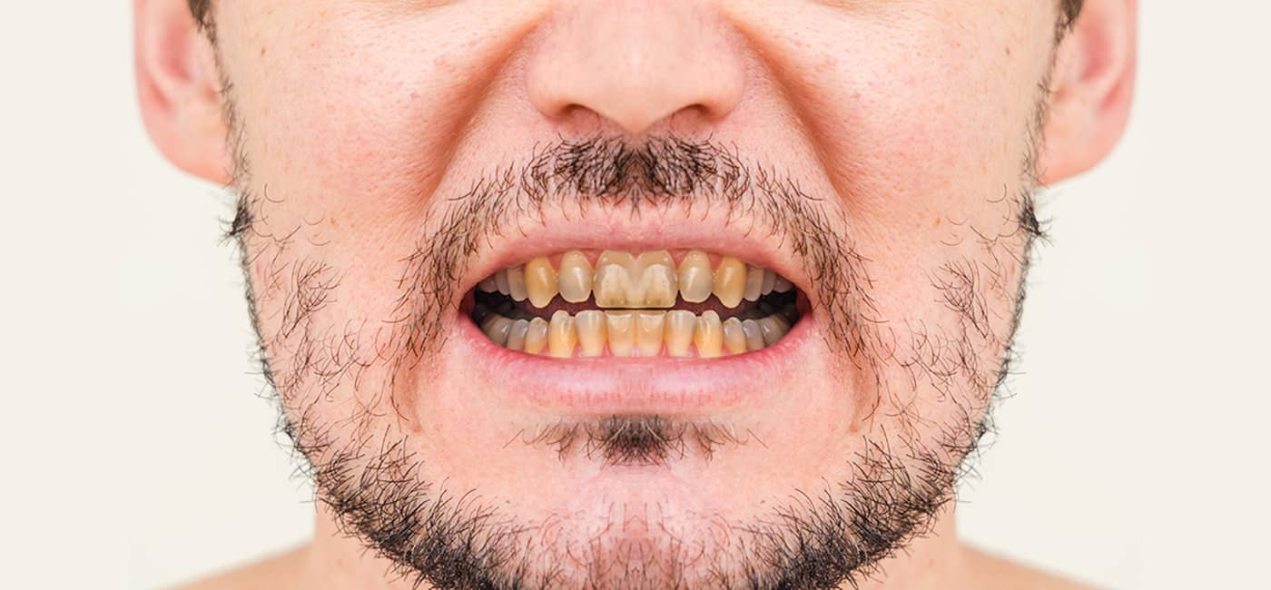 Best Dental Clinic in Navi Peth, Pune | Qualicare Polyclinic