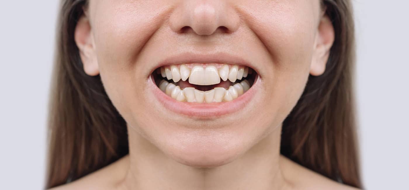 Best Dental Clinic in Navi Peth, Pune | Qualicare Polyclinic